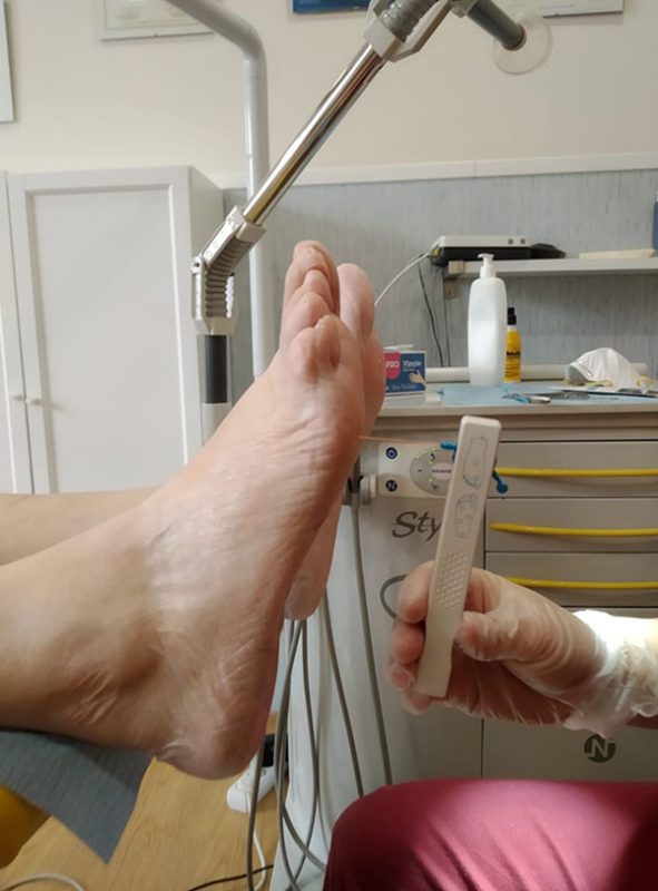 estudio neuropatia diabética Sevilla