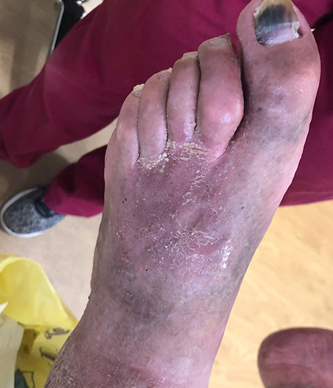 After image