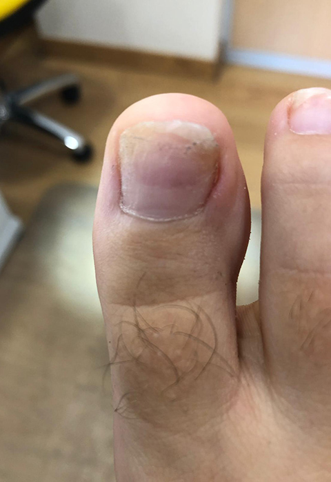 After image